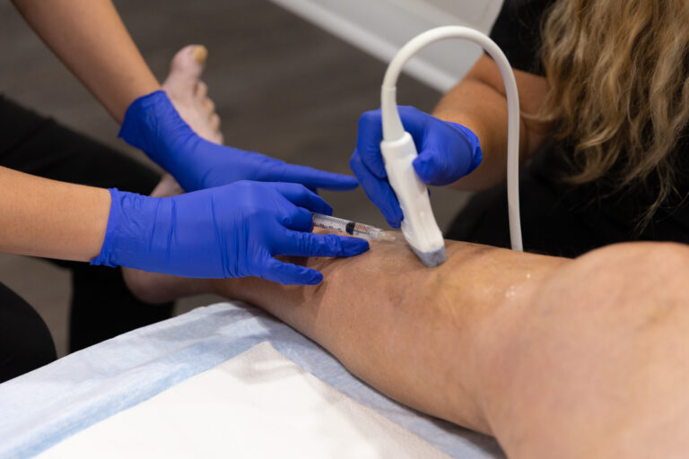 Two providers wearing medical gloves work together to perform a spider vein treatment near Longboat Key.