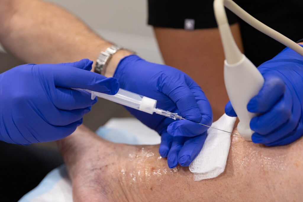 A pair of hands wearing surgical gloves perform a non-surgical vein treatment in Lakewood Ranch.