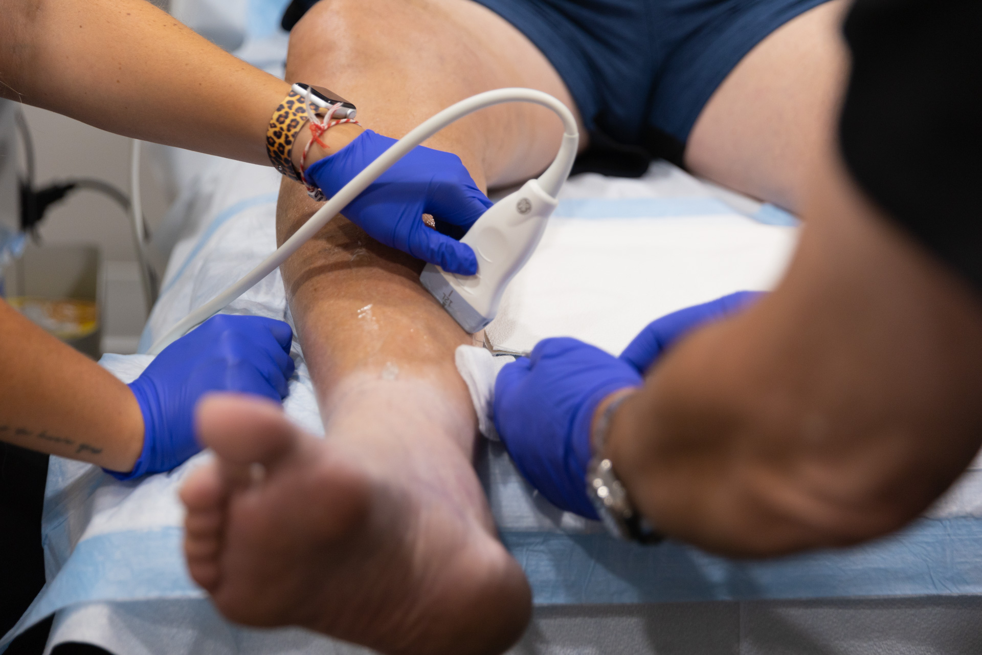 Close-up of a team of vein specialists using nonsurgical vein treatments in Fort Myers.