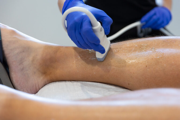 Blue-gloved hands hold a scanning device against a patient's leg for lymphedema treatment in Sarasota
